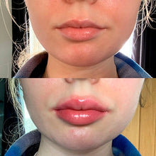 Indlæs billede til gallerivisning Plump It! DUOSÆT No Needles Lip Filler Kit 2x3 ml (vomulising lip plumper + hyaluronic lip plumper)