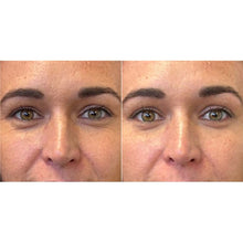 Indlæs billede til gallerivisning Plump It! No Needles Dermal Filler 15 stk x 0,67 ml
