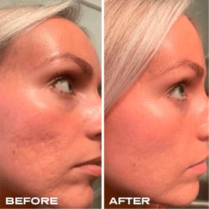 Plump It! No Needles Dermal Filler 15 stk x 0,67 ml