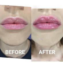 Indlæs billede til gallerivisning Plump It! DUOSÆT No Needles Lip Filler Kit 2x3 ml (vomulising lip plumper + hyaluronic lip plumper)
