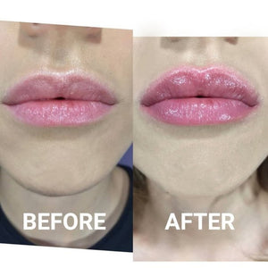 Plump It! DUOSÆT No Needles Lip Filler Kit 2x3 ml (vomulising lip plumper + hyaluronic lip plumper)