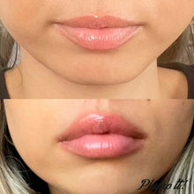 Indlæs billede til gallerivisning Plump It! DUOSÆT No Needles Lip Filler Kit 2x3 ml (vomulising lip plumper + hyaluronic lip plumper)
