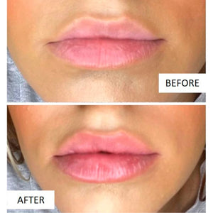 Plump It! DUOSÆT No Needles Lip Filler Kit 2x3 ml (vomulising lip plumper + hyaluronic lip plumper)