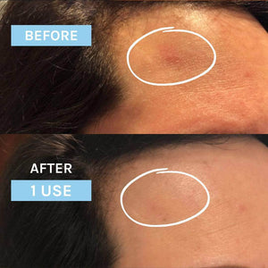 EVOLVE - Blue Velvet Ceramide Serum, 30 ml - Sensitive and dry skin (Beauty Shortlist Awards 2024: Best Serum Redness & Best Serum For Dehydrated Skin)
